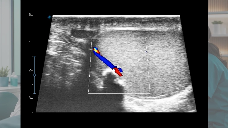 Imagen representativa del XI. MÓDULO DE ABDOMEN 2
