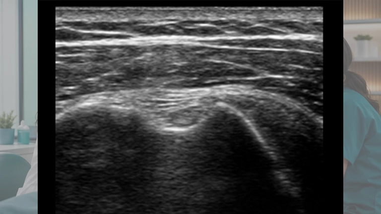 Imagen representativa del XIV. MÓDULO DE VASCULAR