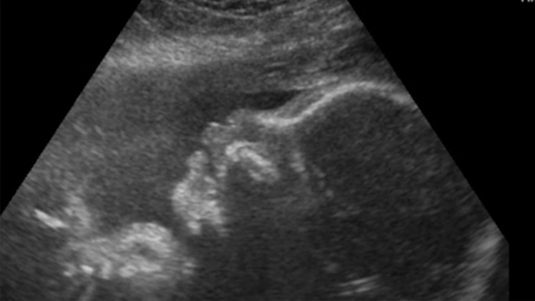 Imagen representativa del VI. MÓDULO DE OBSTETRICIA 2
