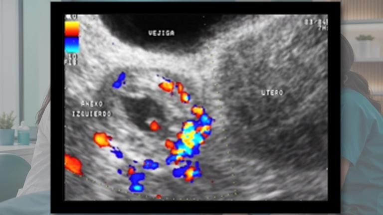 Imagen representativa del VIII. MÓDULO DE OBSTETRICIA 4